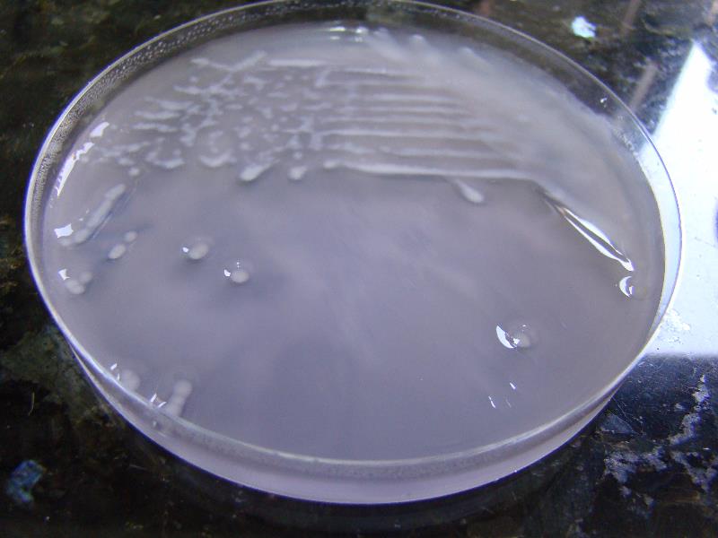 Bacterias creciendo en medio de cultivo selectivo